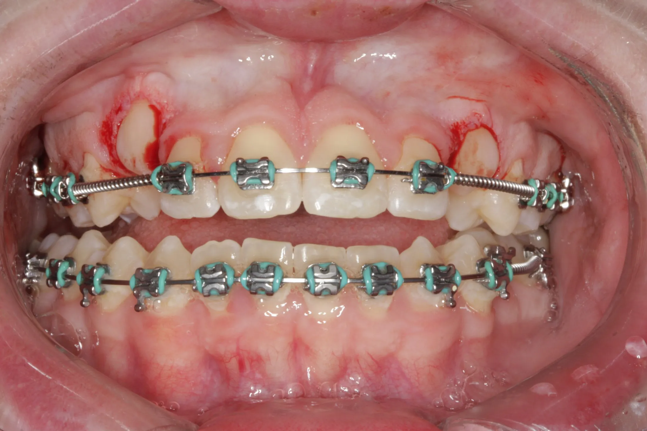 Canine exposure case study