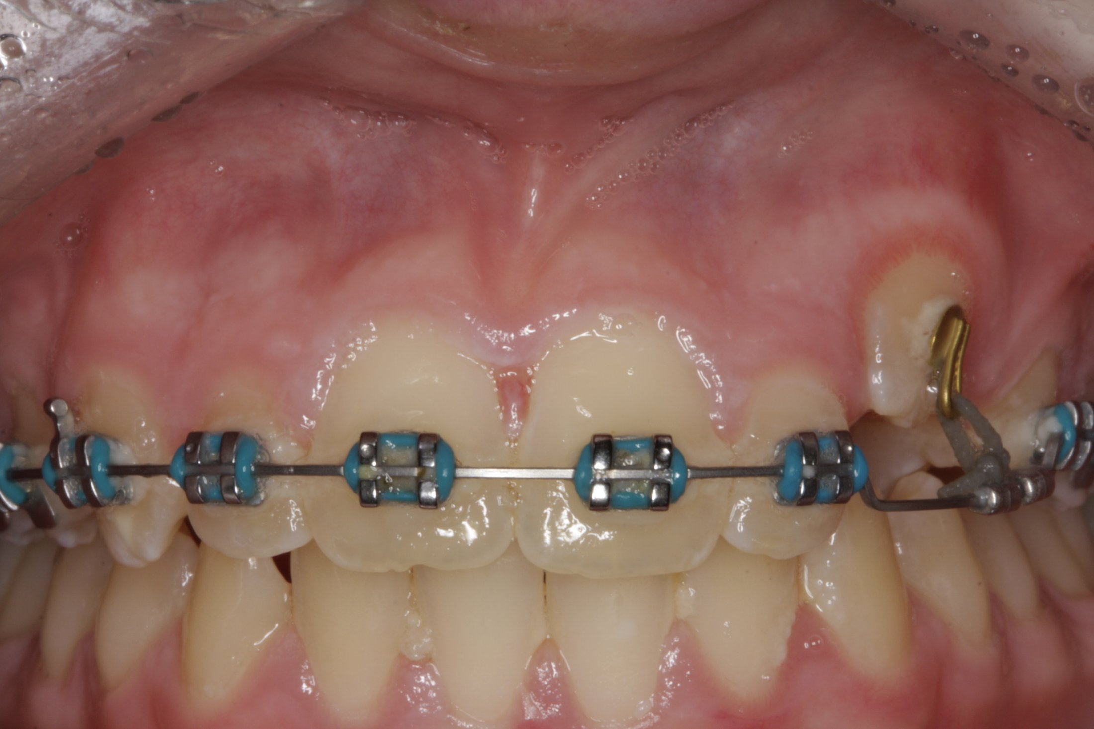 Canine exposure case study