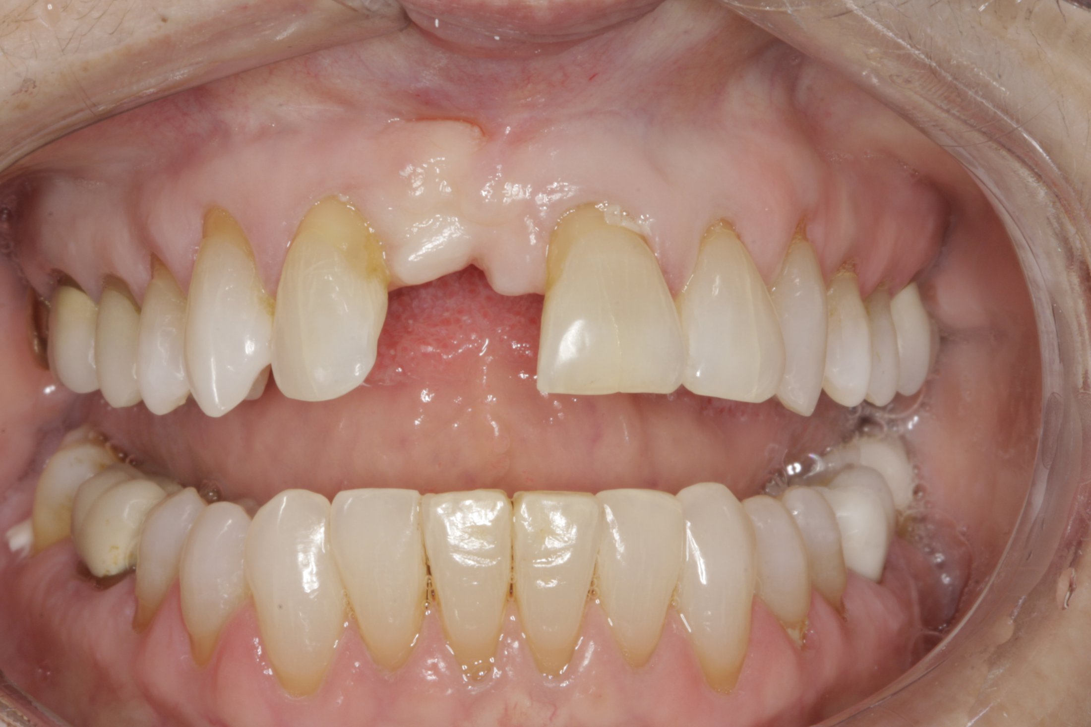 Guided Surgery case study