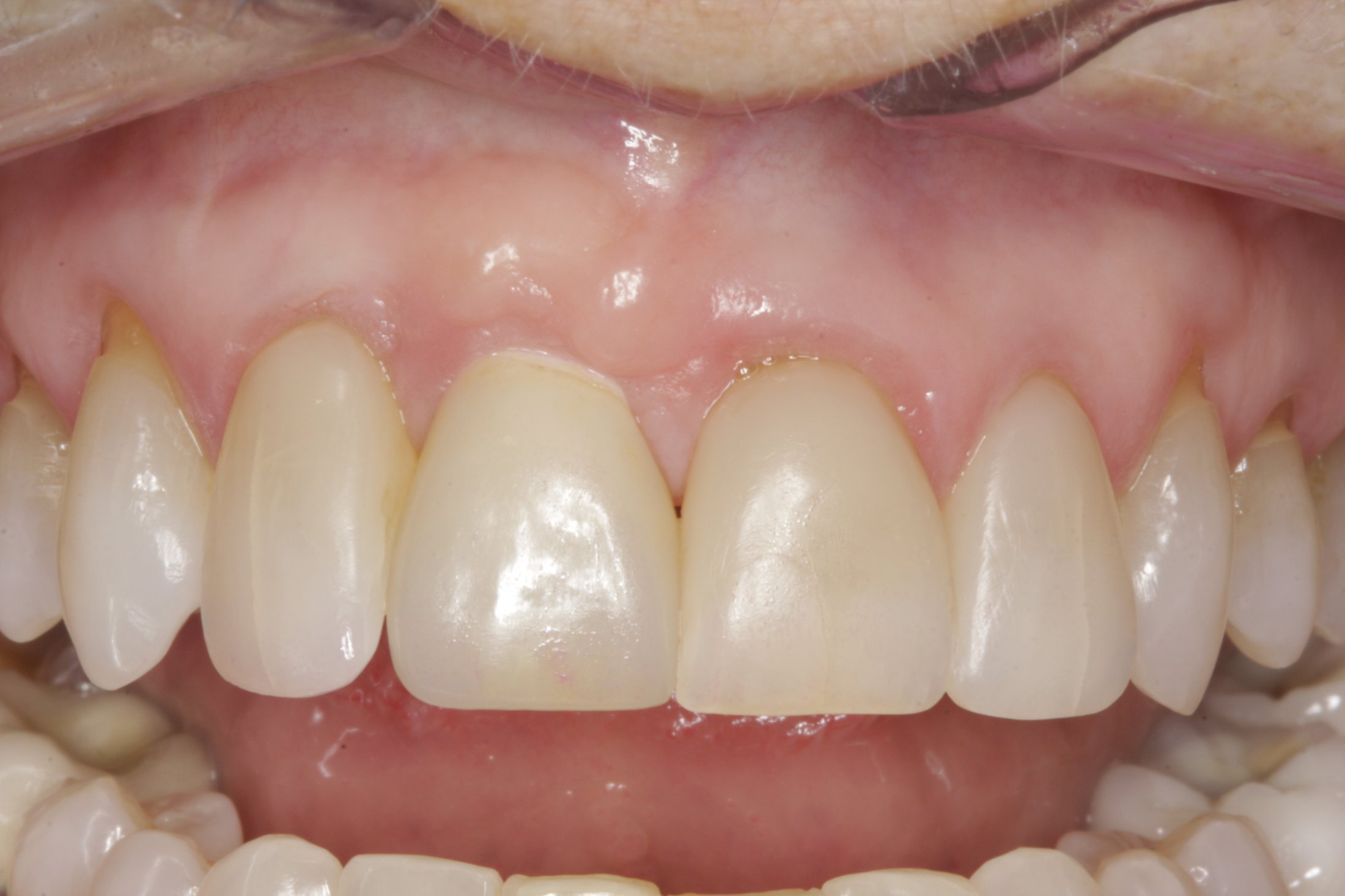 Guided Surgery case study